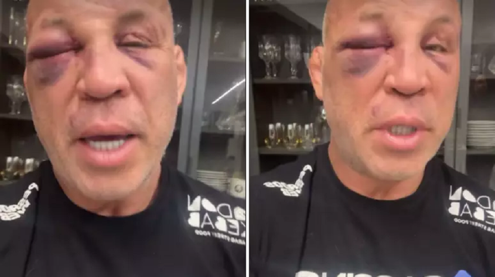 Wanderlei Silva relata dores e perda de memória após briga: ‘Magoado por dentro e por fora’